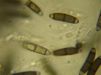 Chaetosphaerella