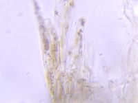 Lepiota